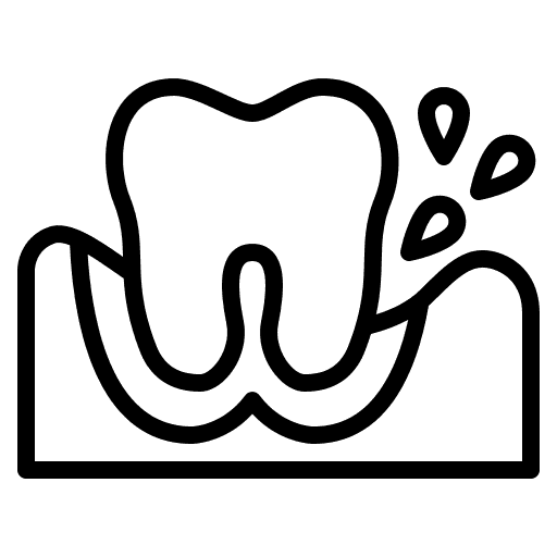 Gum Surgery & Grafting