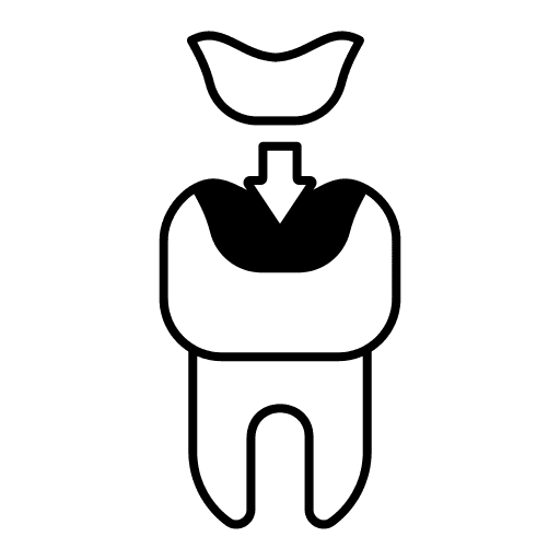 Inlays, Onlays & Veneers